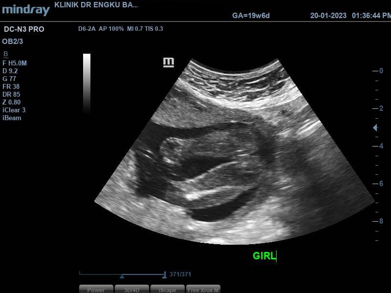 Promo SCAN BABY - Laman Keluarga